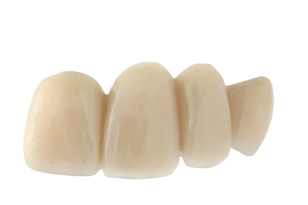 Improve Your Oral Health With A Dental Bridge