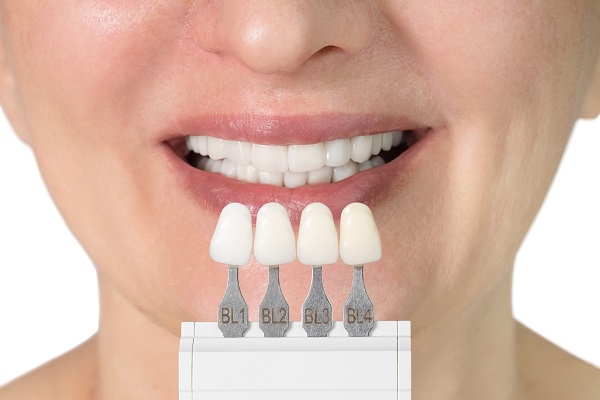 Dental Veneers &#    ; A Teeth Straightening Solution Without Braces