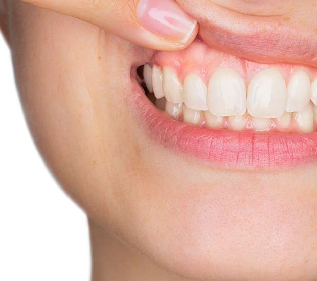 Temecula Gum Disease