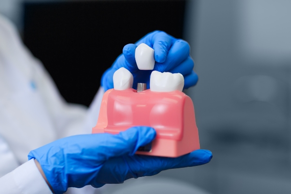 The Process Of Getting A Dental Implant After A Tooth Extraction